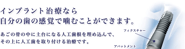 インプラント治療なら自分の歯の感覚で噛むことができます。