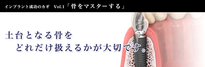 インプラント成功のカギ １「骨をマスターする」